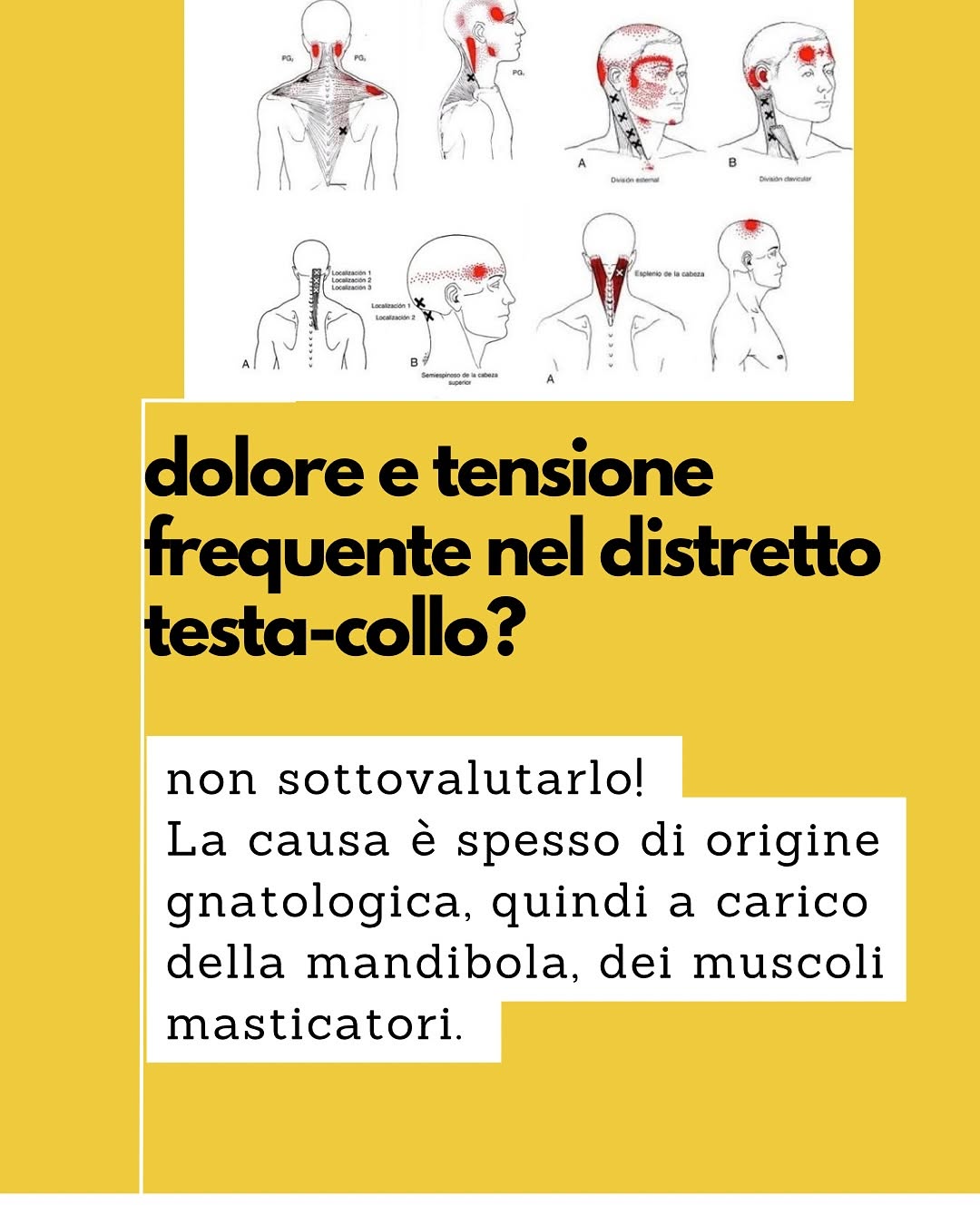 CEFALEA TENSIVA